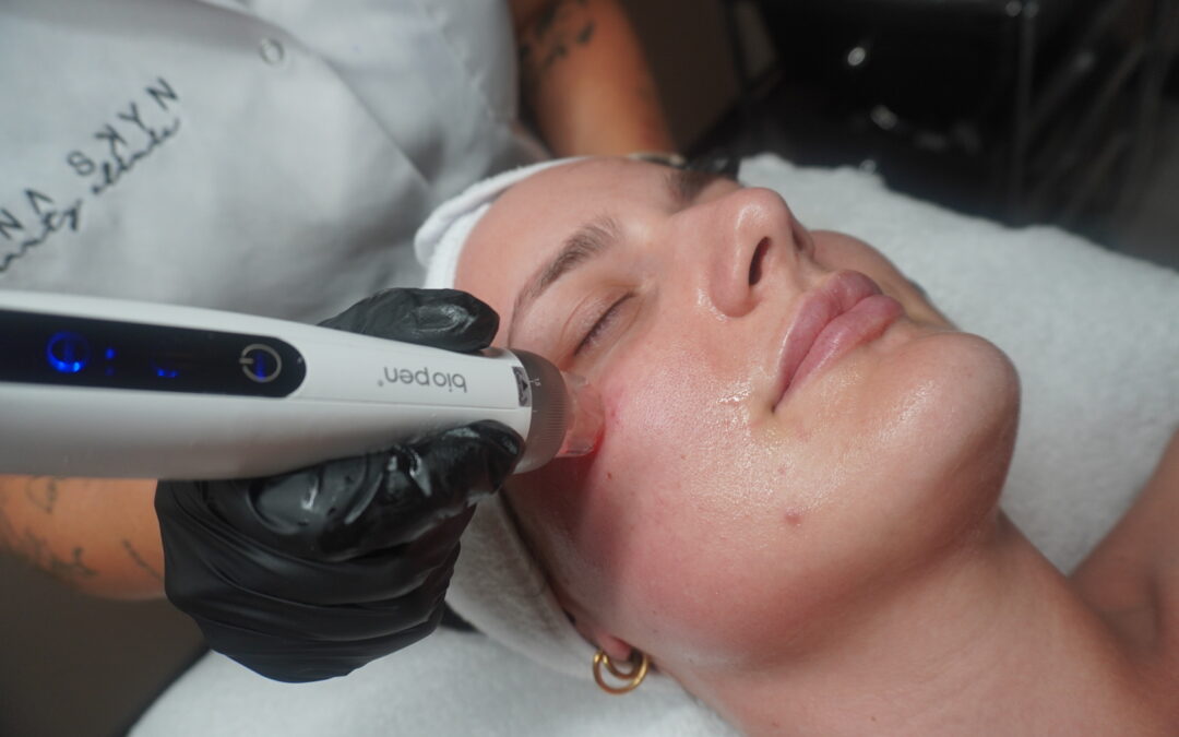 EEN FRISSE RESET VOOR HET VOORJAAR BIJ LANA SKYN